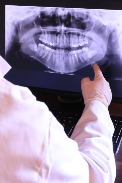 Best Emergency Root Canal Treatment in Santa Fe, TX