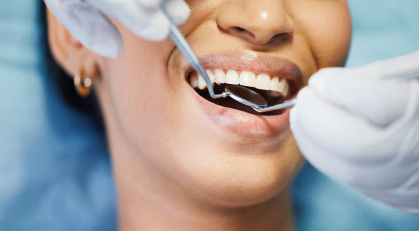 Best Broken or Cracked Tooth Emergency Dentist in Santa Fe, TX